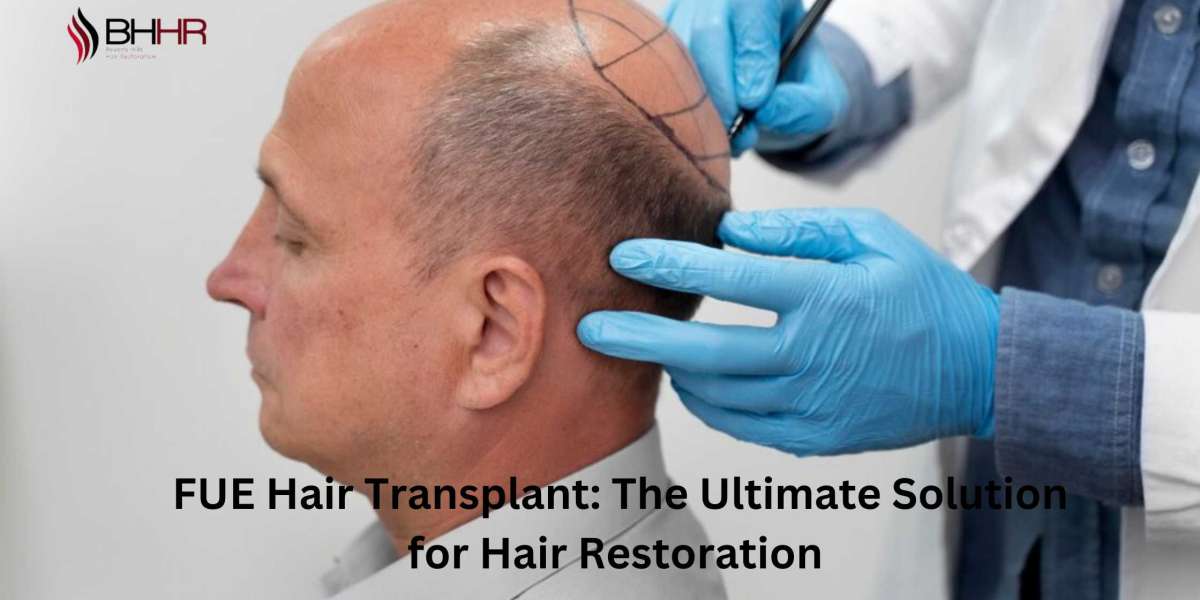 FUE Hair Transplant: The Ultimate Solution for Hair Restoration