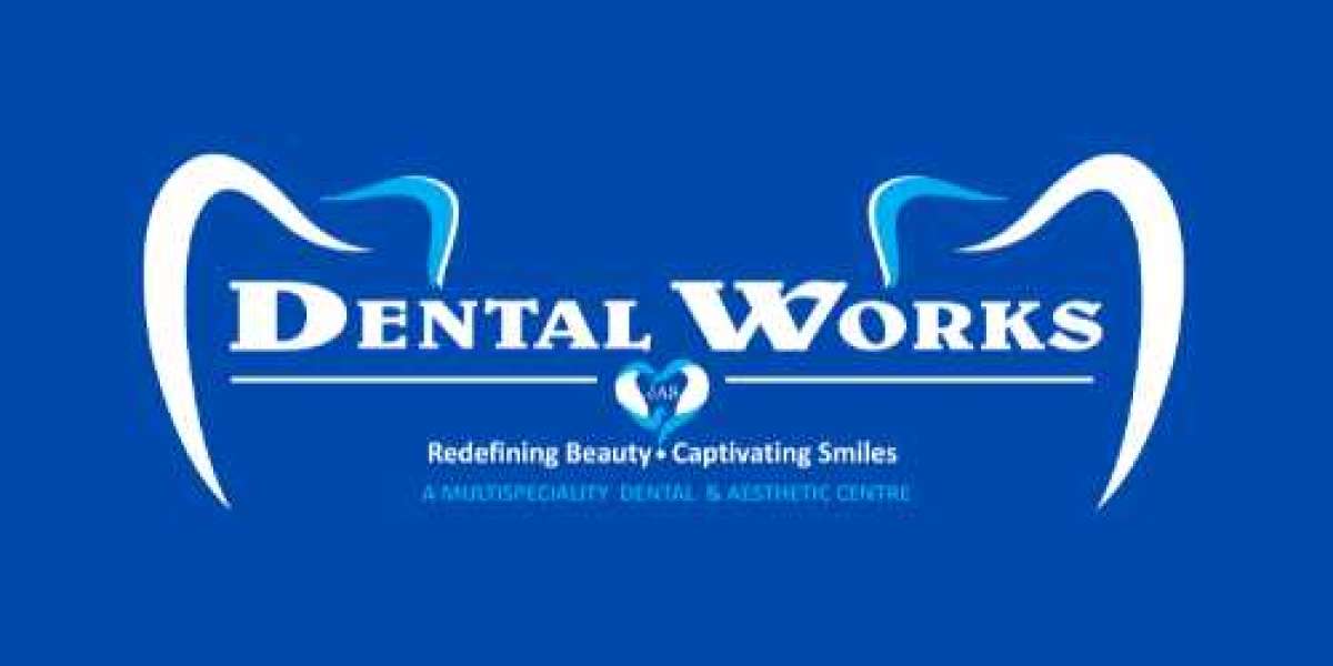 Unveiling Excellence: Dental Works Clinic – Your Premier Dental Destination in Paschim Vihar