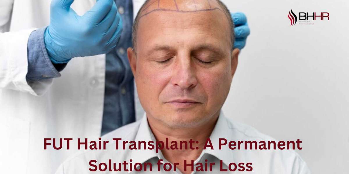 FUT Hair Transplant: A Permanent Solution for Hair Loss